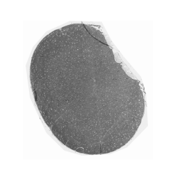 compendium_optic_nerve